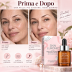 SKIN LURONIC™ Siero Viso Antirughe effetto lifting